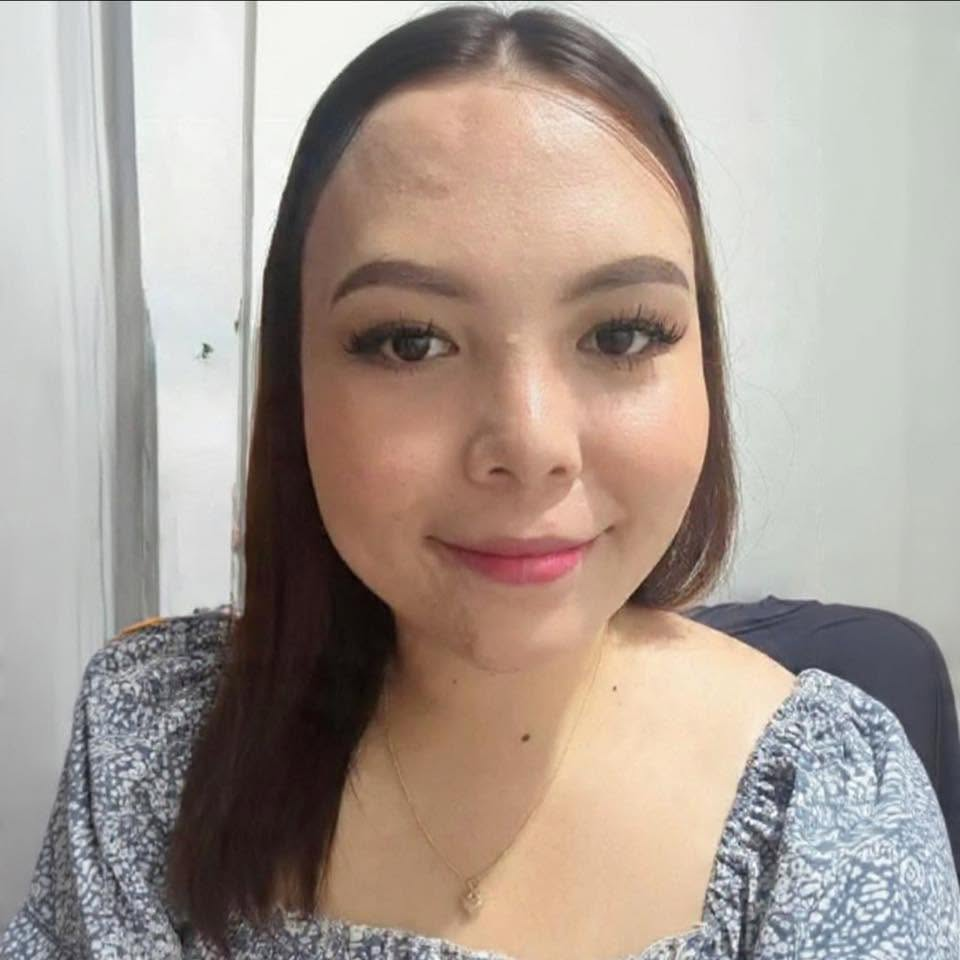 Vernie Redondo
